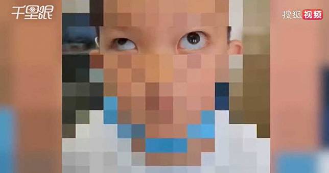 6歲男童模仿App凸眼特效　竟「徒手挖眼球」…左眼外凸險失明