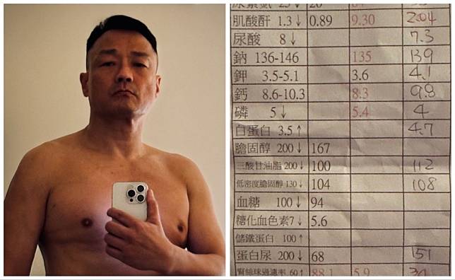 57歲王喜自揭患末期腎衰竭。