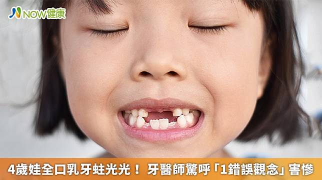 ▲有些父母認為「反正會換牙，乳牙即使蛀光也沒關係！」陳宜宏醫師提出指正，強調乳牙蛀壞若未適當治療，恐影響日後恆牙的生長。（圖／NOW健康製作；圖片來源／ingimage）