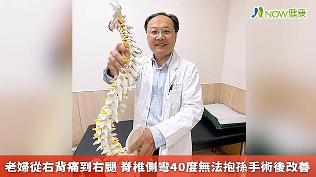▲林志隆醫師表示，患者3年前其實就已經發現有脊椎側彎的問題，但因患者害怕手術後遺症，才導致狀況日益惡化。（圖／亞大醫院提供）