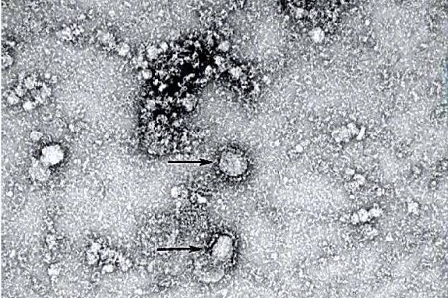 2020年1月24日，中國國家病原微生物資源庫發布新型冠狀病毒電鏡照片（微博）