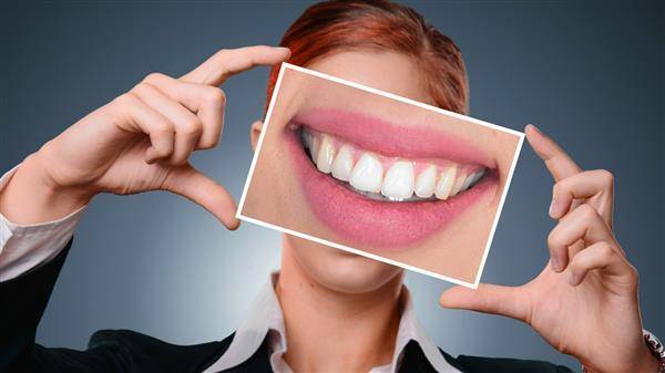 牙齒也成為審美的重要條件之一。翻攝Pixabay
