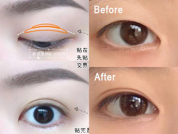 不同眼型的「雙眼皮貼法」一次性大公開！附3款超隱形雙眼皮貼！輕鬆貼  