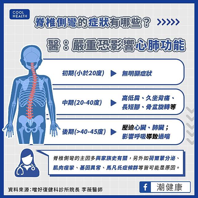 脊椎側彎的好發族群有哪些？  嚴重者恐影響「心肺功能」？