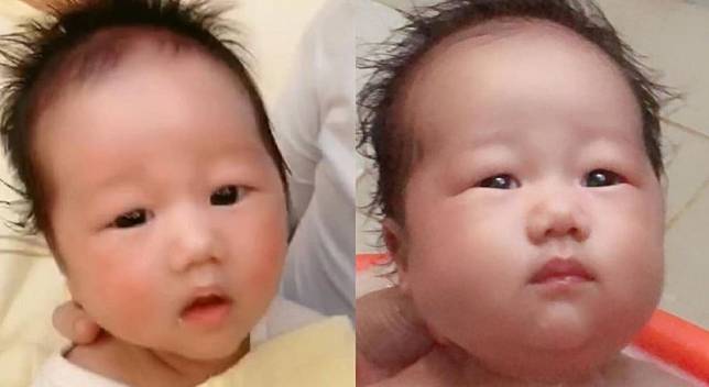 出生1個月又21天的女嬰被外婆帶回家養(左)，回來整個臉餵腫約1吋(右)。(女嬰母親提供)