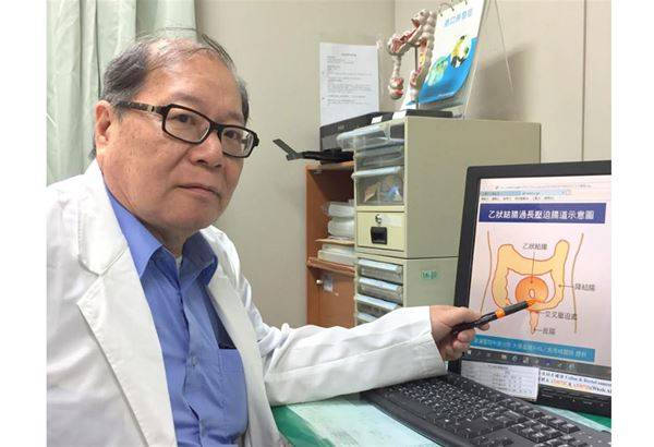 台中澄清醫院中港院區大腸直腸外科主治醫師馬秀峰表示，乙狀結腸過長的人，年紀增大越有扭結的風險。（圖片提供／澄清醫院）
