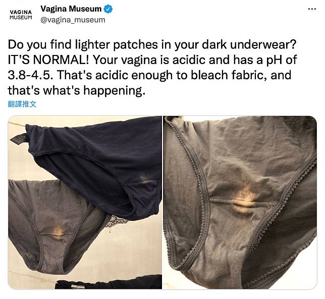 倫敦首間陰道博物館日前揭露女性內褲變色的原因在於分泌物的酸鹼值所致。圖／翻攝自陰道博物館推特