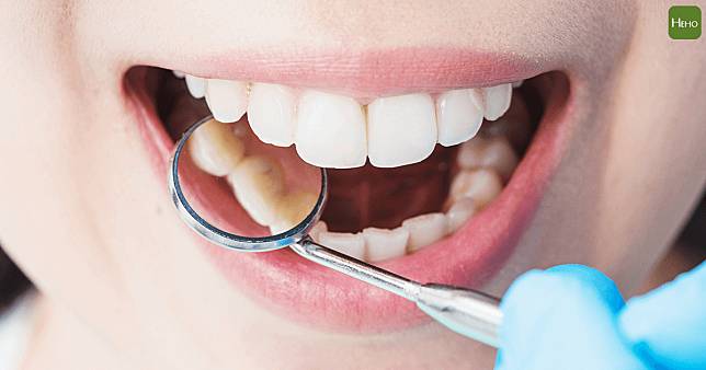 不同年齡層接觸到四環黴素，牙齒呈現深色的部位與範圍也不同。