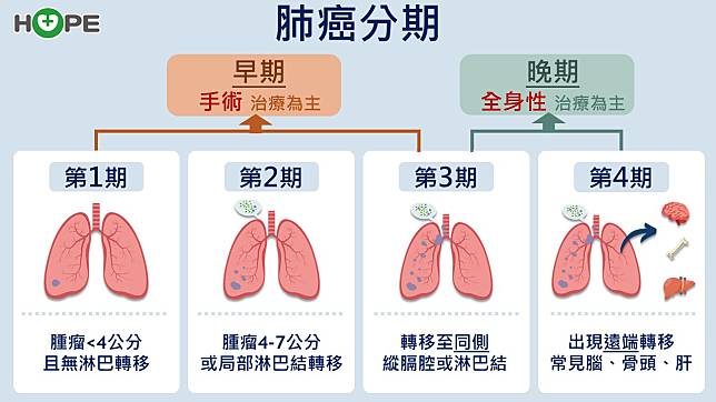 肺癌分期</p><p>