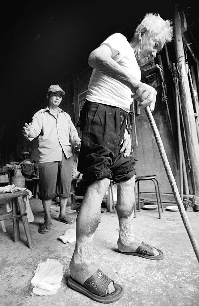 File photo shows a victim of Japanese germ warfare committed in China during World War II leans on a walking stick in Yiwu, east China's Zhejiang Province. (Xinhua)