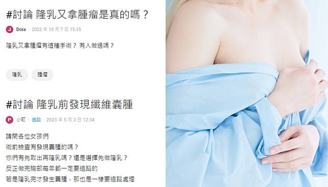 Dcard上有網友詢問，隆乳前發現乳房有纖維囊腫該怎麼辦？