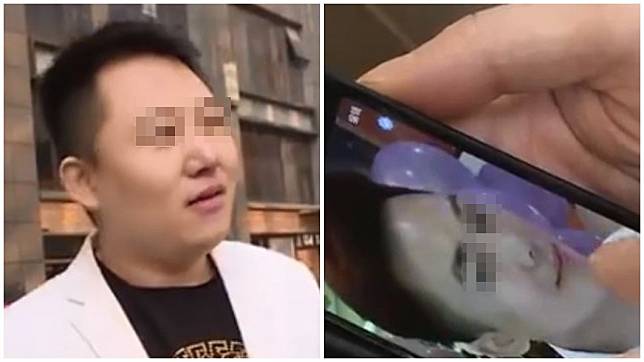 大陸一名男子不滿自己的鼻子被整成蒜頭鼻，怒嗆醫院：我靠臉吃飯耶！（圖／翻攝自微博）