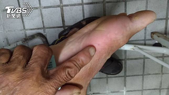 老翁洗澡時腳被虎頭蜂螫傷。（圖／TVBS）