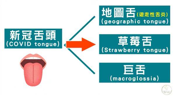 「新冠舌頭」三種類型。（圖／YouTube）
