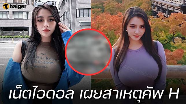 เน็ตไอดอล หน้าอกคัพ H เผยภาพเอกซเรย์ ของแท้แม่ให้มา แถมยังใหญ่ได้อีก!