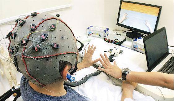 腦機界面——「腦機界面」科技配合肌肉電刺激治療，是糅合大腦想像動作療法、生物回饋刺激，以及肌肉電刺激治療於一身的新治療模式。（作者提供）