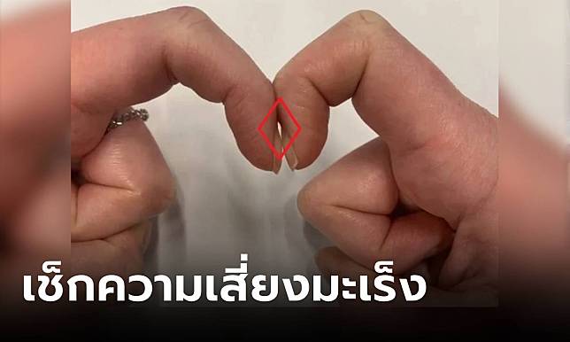 แค่ทำมือตามนี้!