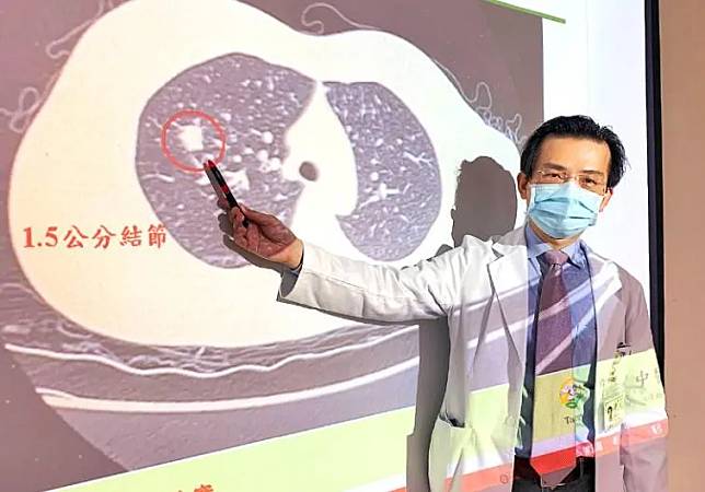 一名51歲陳女士去年底確診新冠肺炎，解隔離後咳嗽不但未緩解還更嚴重。（圖／台中醫院）