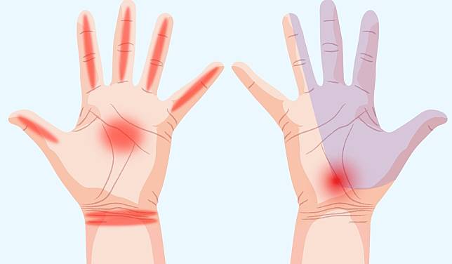 7 สัญญาณเตือน อาการปวดมือ บ่งบอกถึงปัญหาสุขภาพของคุณได้!!