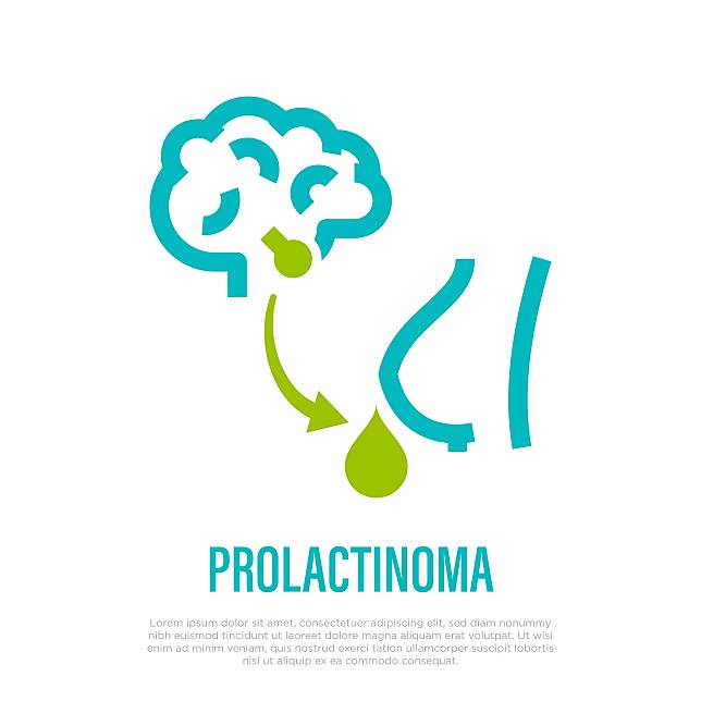Prolactinoma,Thin,Line,Icon.,Benign,Tumor,,Adenoma.,Hyperprolactinemia.,Healthcare,And