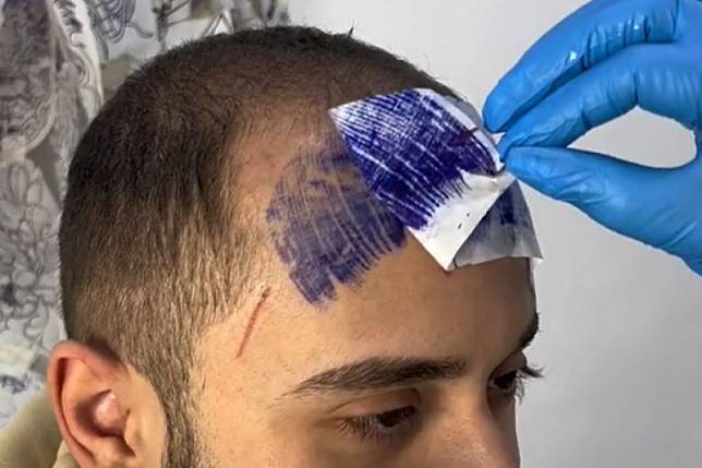 義大利26歲男子為遮髮際線而刺青瀏海。（圖／TiKTok：gipsygtattooer）