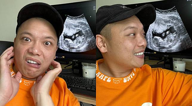 阿虎與圈外女友交往1年，如今曬出超音波照宣布即將當爸。（翻攝自阿虎臉書）