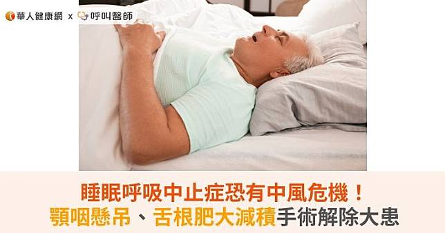 睡眠呼吸中止症恐有中風危機！顎咽懸吊、舌根肥大減積手術解除大患