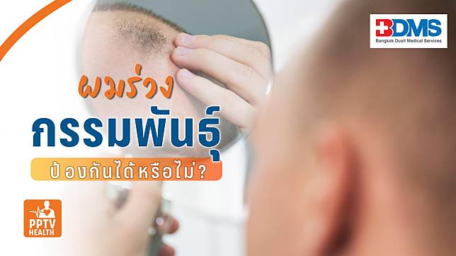 ผมร่วง ผมบาง ศีรษะล้าน จากกรรมพันธุ์ ป้องกันรักษาได้หรือไม่?