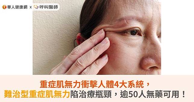 重症肌無力衝擊人體4大系統，難治型重症肌無力陷治療瓶頸，逾50人無藥可用！
