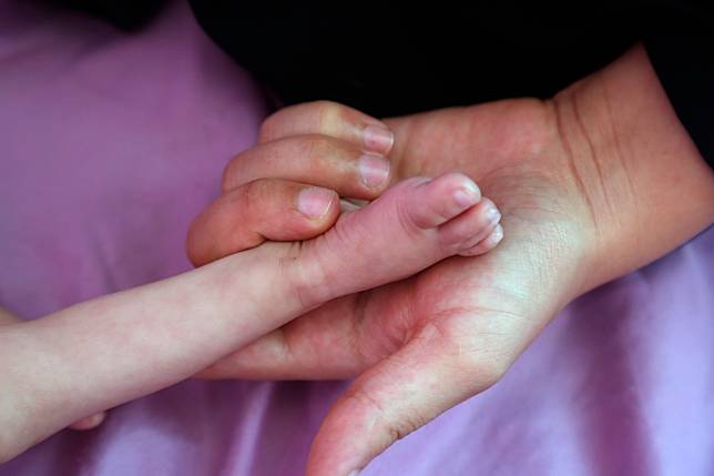 A medic holds the foot of a malnourished child as the baby receives treatment at Al-Sabeen hospital, in Sanaa, Yemen, on July 30, 2023. (Photo by Mohammed Mohammed/Xinhua)