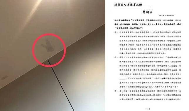 有網友PO照控訴聖宜診所桃園店的天花板疑似有錄影設備拆除的痕跡（左圖）；針對診間監視器風波，聖宜診所透過律師發布聲明，強調錄影是為了釐清醫療爭議，且所有患者均簽署同意書。（翻攝自Threads、診所臉書）