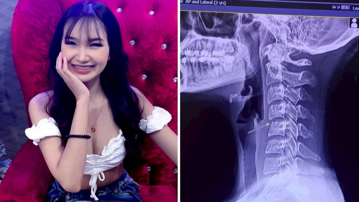 20歲女歌手做泰式按摩lock頸致半身癱瘓1個月後離世| 娛樂on LINE | LINE TODAY