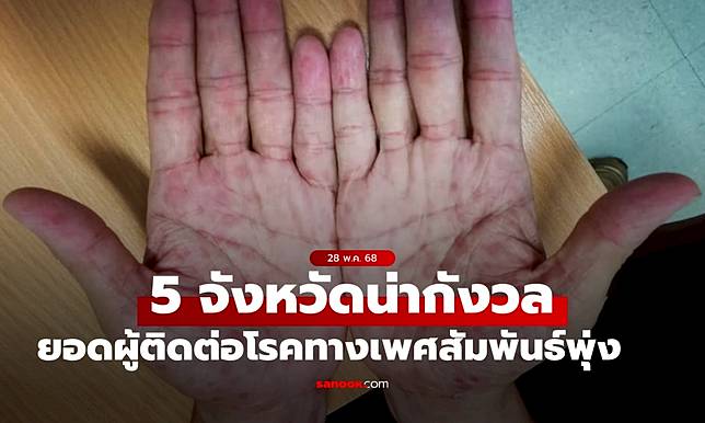 กองโรคเอดส์ เปิดรายชื่อ 5 จังหวัดน่ากังวล โรคติดต่อทางเพศสัมพันธ์ ยอดผู้ป่วยพุ่ง!