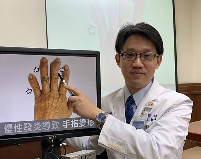 手指染退化性關節炎腫脹疼痛　長年勞動者要注意保養