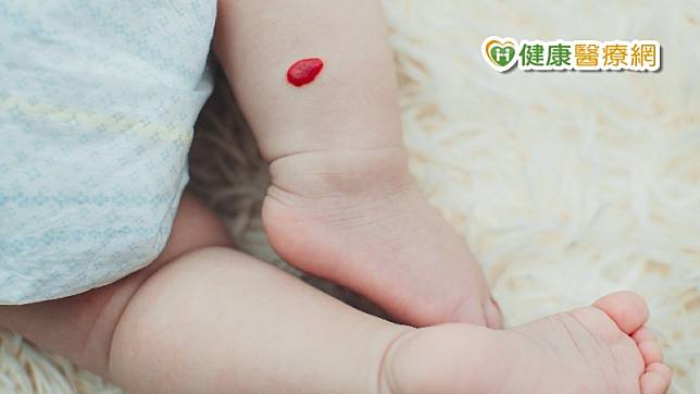 臺北市立聯合醫院陽明院區小兒科主治醫師呂馨詠說，嬰兒血管瘤的發生率約5%，為嬰兒時期最常見的良性腫瘤。