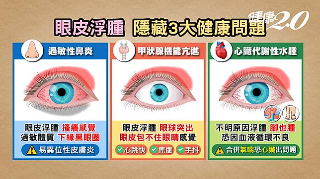 3眼疾
