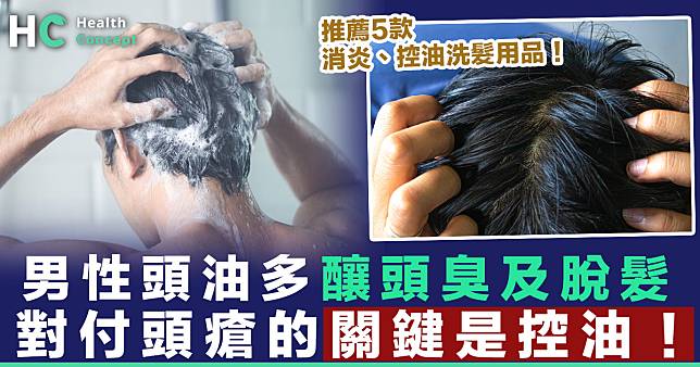【頭瘡發炎】男性頭油多釀頭臭及脫髮  對付頭瘡的關鍵是控油！
