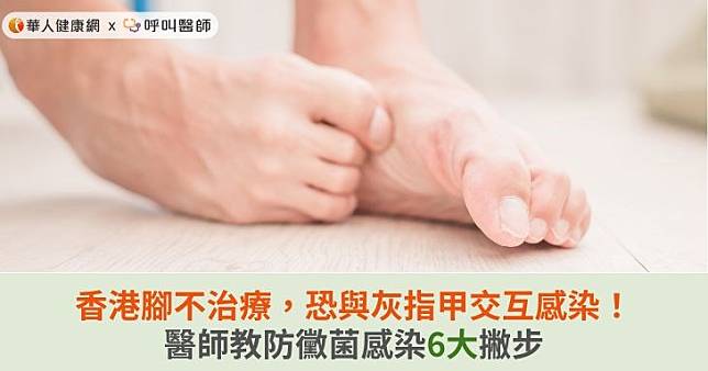 香港腳不治療，恐與灰指甲交互感染！醫師教防黴菌感染6大撇步