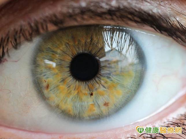 早期發現、早期治療是阻止許多常見眼疾進展的關鍵。