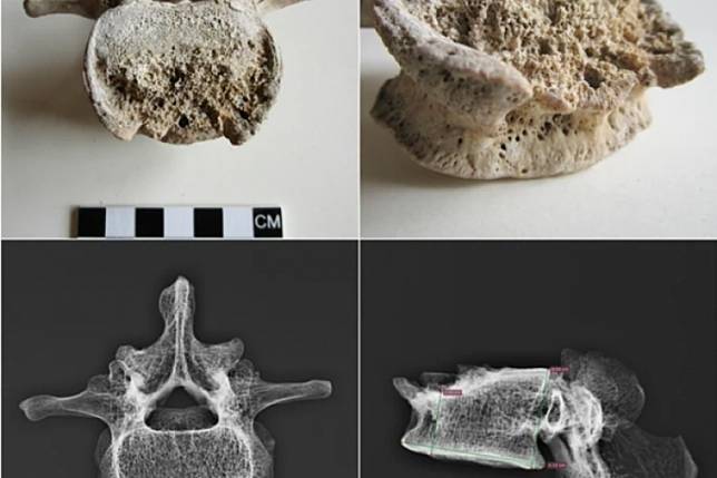 科學家首度成功為義大利龐貝古城罹難者做基因定序（翻攝自www.nature.com）