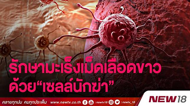 จุฬาฯ แถลงก้าวแรกความสำเร็จรักษามะเร็งเม็ดเลือดขาวด้วย “เซลล์นักฆ่า” 