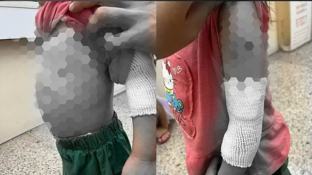 媽夥同居男施虐，3歲女童瘀青肋骨斷。（圖／翻攝自爆料公社）