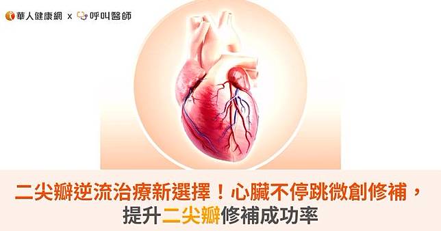 二尖瓣逆流治療新選擇！心臟不停跳微創修補，提升二尖瓣修補成功率
