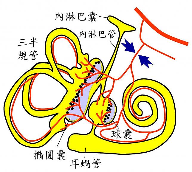 醫師陳建志說明，迷路動脈缺血（藍色箭號所指）會使耳蝸、球囊、橢圓囊及三半規管受到程度不一的傷害。（陳建志醫師提供）