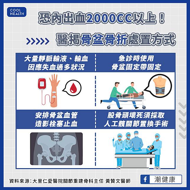 骨盆骨折多為年輕族群  恐內出血2000CC以上