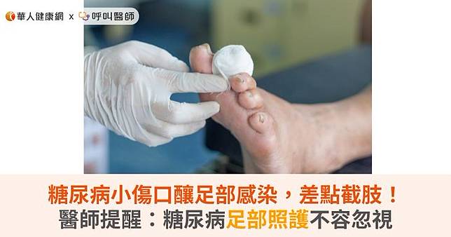 糖尿病小傷口釀足部感染，差點截肢！醫師提醒：糖尿病足部照護不容忽視