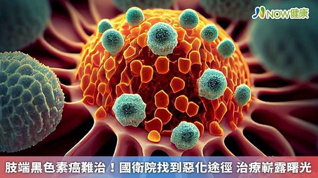 ▲國家衛生研究院癌症研究所沈哲宏助研究員領導團隊與高雄醫學大學及日本九州大學合作，進行跨國肢端黑色素癌研究，破解了其中的惡化途徑，有望助攻標靶治療發展。（圖／NOW健康製作；圖片來源／ingimage）