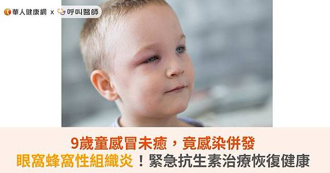 9歲童感冒未癒，竟感染併發眼窩蜂窩性組織炎！緊急抗生素治療恢復健康