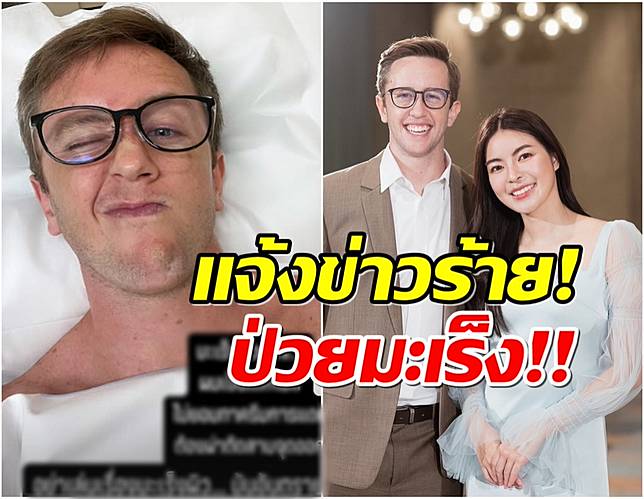 เเฟนๆช็อก เนท My Mate Nate เเจ้งข่าวร้ายป่วยมะเร็งผิวหนัง