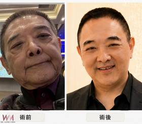 逼近70歲小亮哥凍齡回春驚艷眾人　愛照鏡子老婆笑稱臉比她還緊